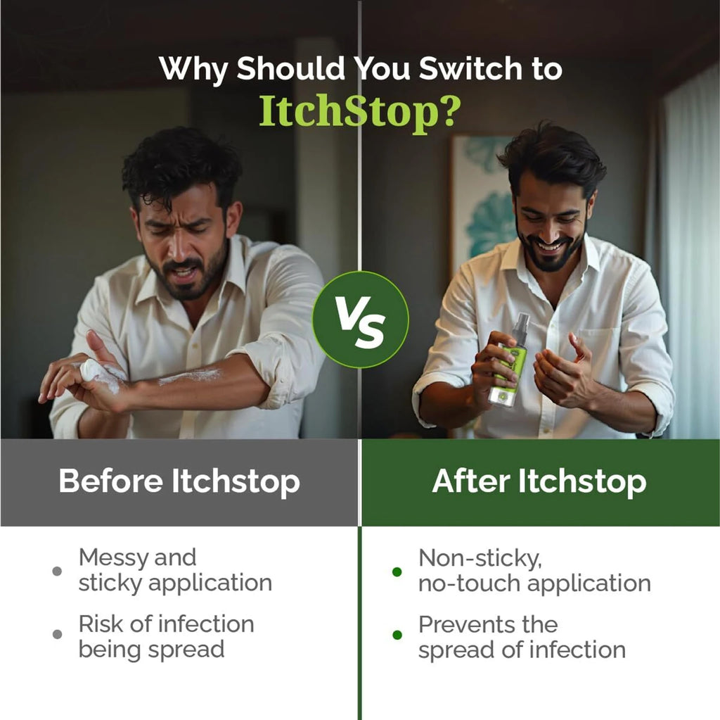 ItchStop Antifungal Spray | Fast-Drying Skin Care Spray for Itching, Ringworm, Jock Itch & Athlete's Foot | 35ml