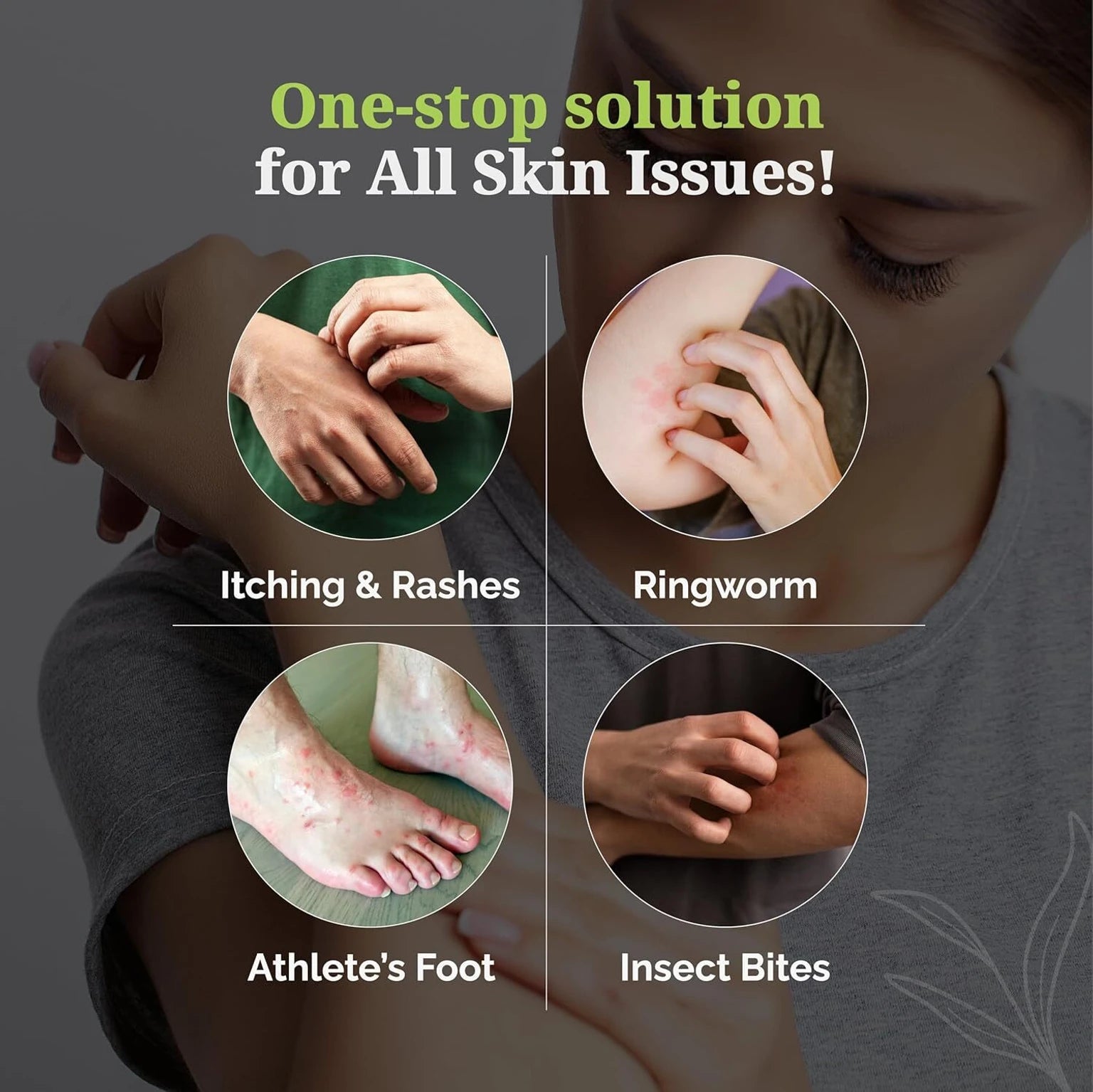 ItchStop Antifungal Spray | Fast-Drying Skin Care Spray for Itching, Ringworm, Jock Itch & Athlete's Foot | 35ml