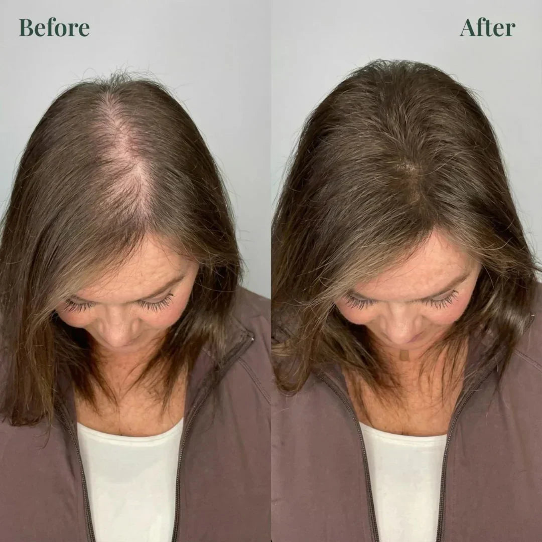 Kerarose Rosemary Shampoo For Hair Growth (Buy 1 Get 1 Free 🔥🔥)
