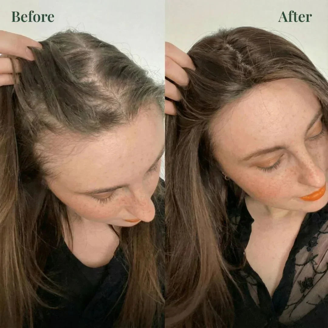 Kerarose Rosemary Shampoo For Hair Growth (Buy 1 Get 1 Free 🔥🔥)